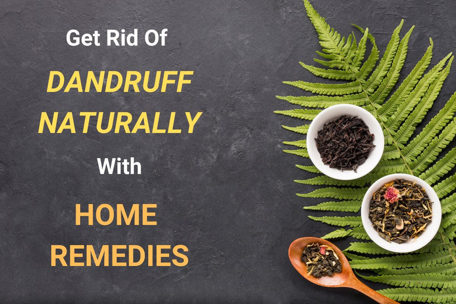 Get Rid of Dandruff Naturally with Home Remedies - White Wolf India