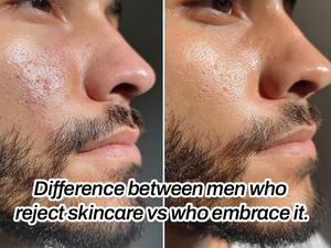 Men Who Reject Skincare vs. Men Who Embrace It