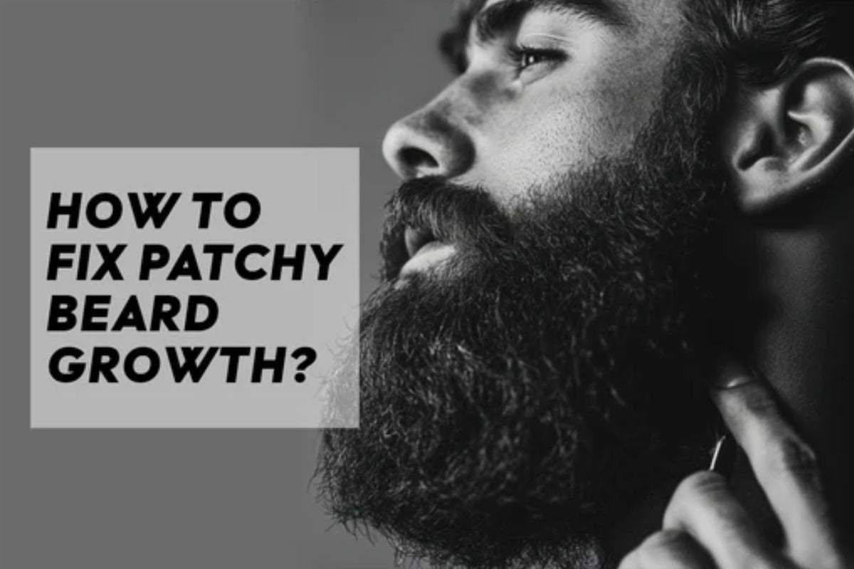 How to Fix Patchy Beard Growth? - White Wolf India