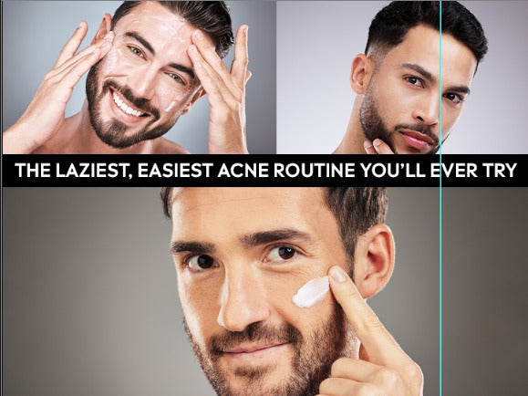 The Laziest, Easiest Acne Routine You’ll Ever Try