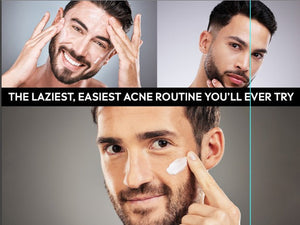 The Laziest, Easiest Acne Routine You’ll Ever Try