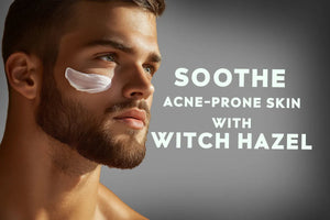 Soothe Acne-Prone Skin with Witch Hazel