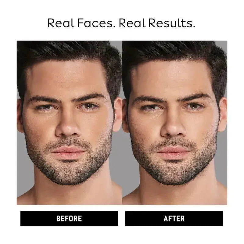 before after face results, after using sunscreen cream for men's face