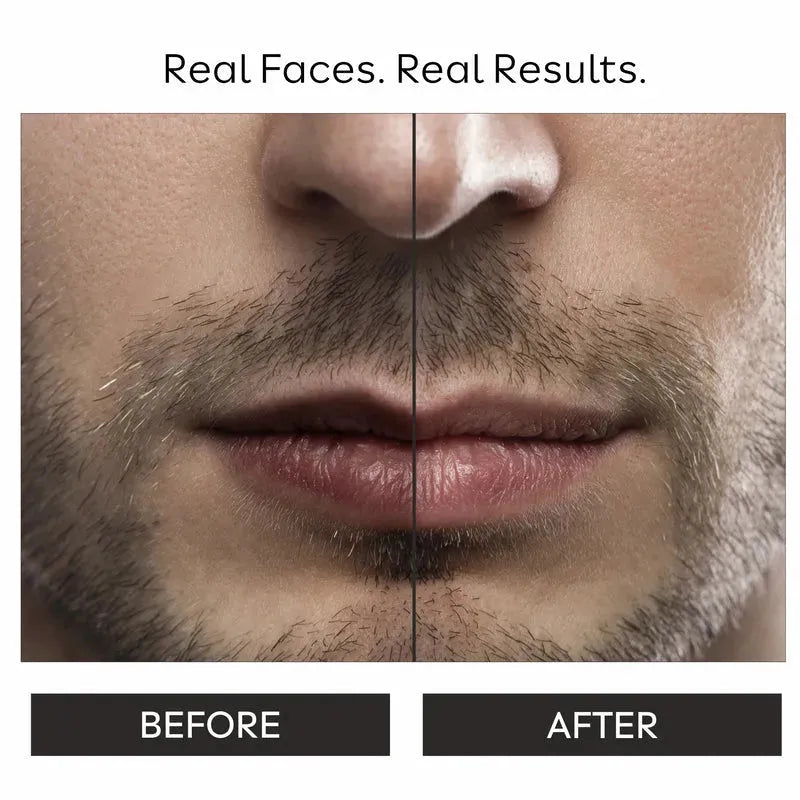 lip balm before and after results