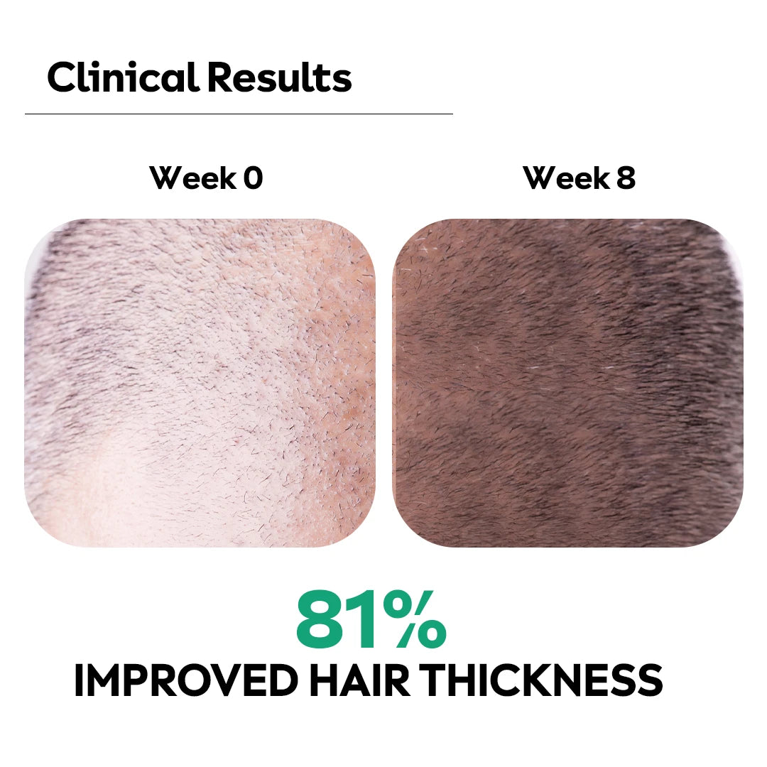 Scalp serum non greasy hair growth serum texture shot on fingertips 