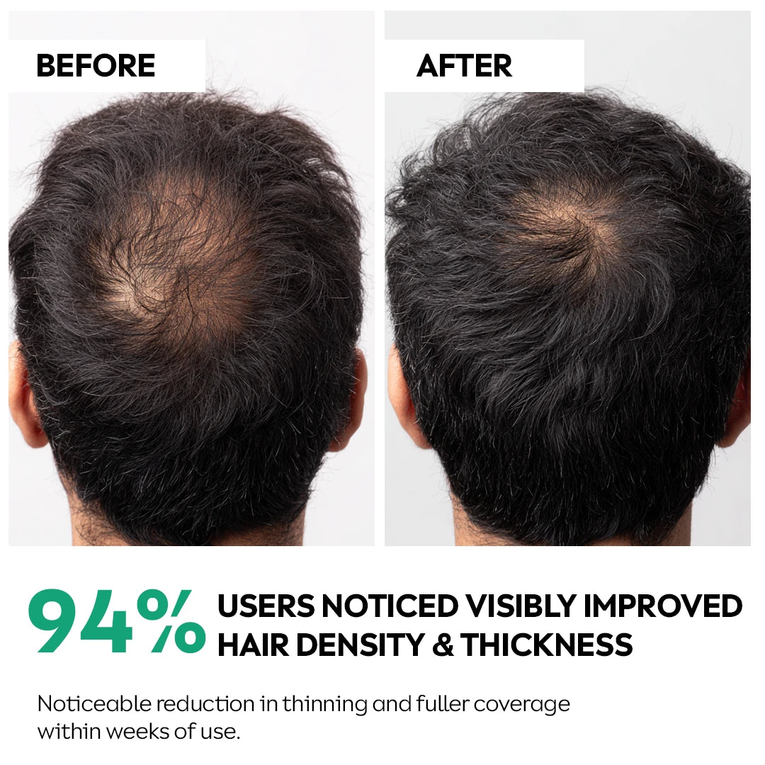 Hair serum for men targeted thinning areas stronger roots and density support