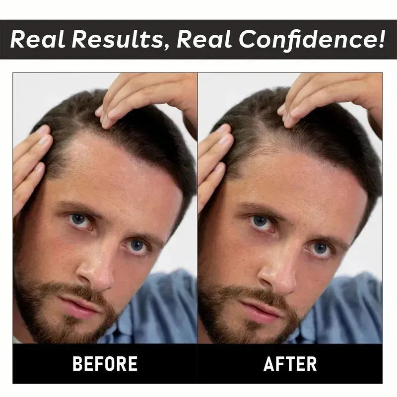 before after hair growth results