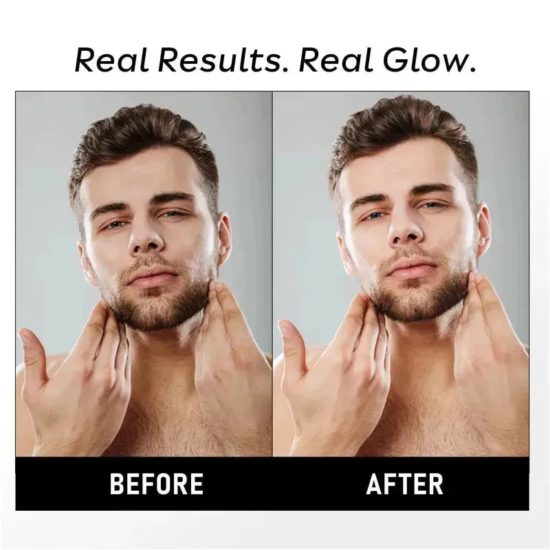 Before and after results of hydro booster gel cream – visibly hydrated, smoother, and healthier-looking skin