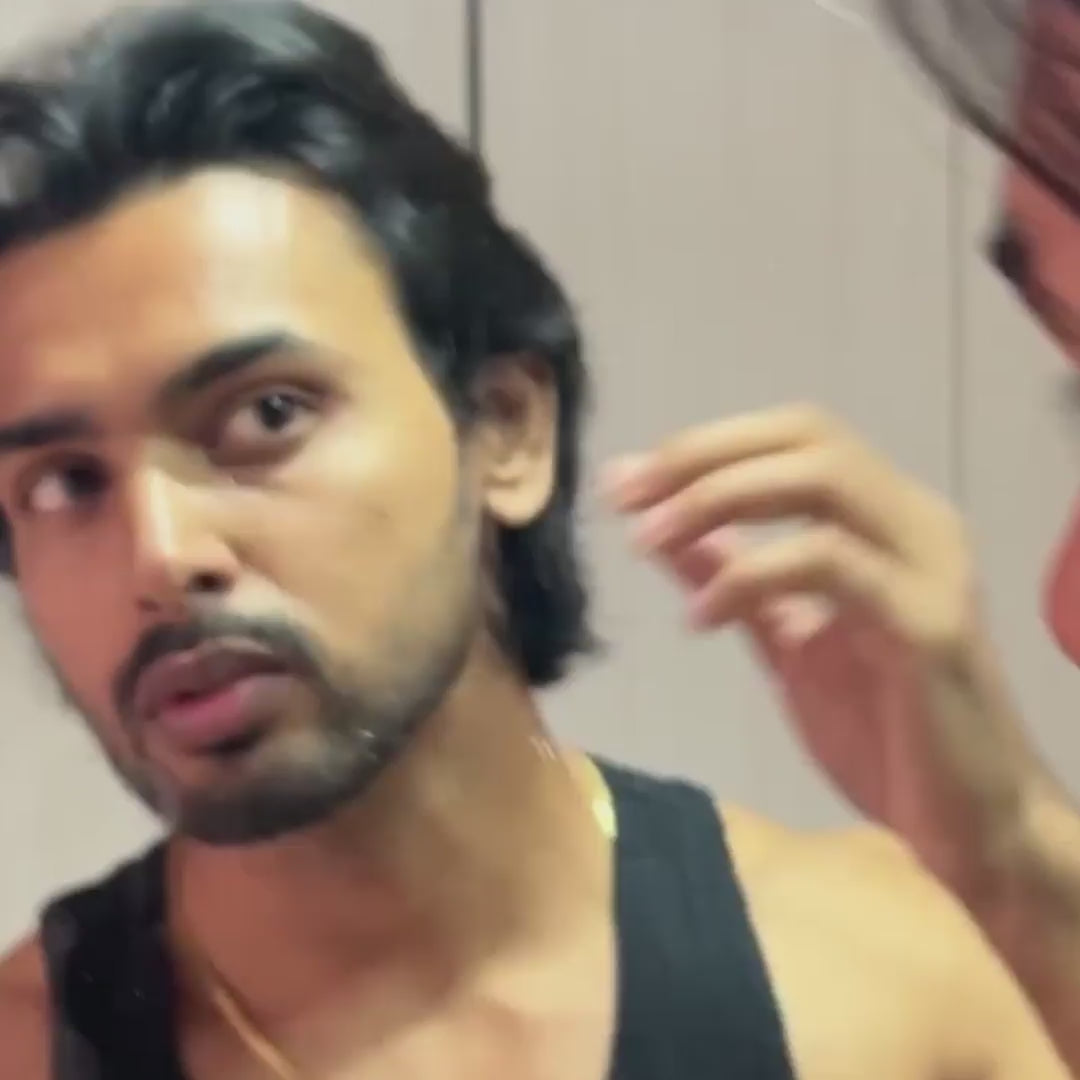 Man applying acne cleanser on face and revealing clearer skin – before and after results video